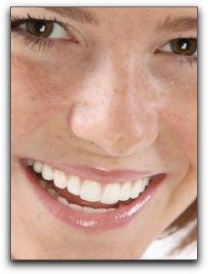 great-smilegum-contouring | Parkview Dental | Dentist Royal Oak, MI